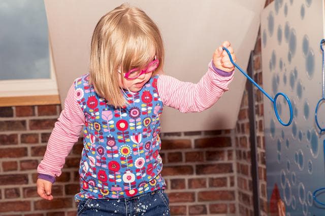 다운 증후군 수명 2