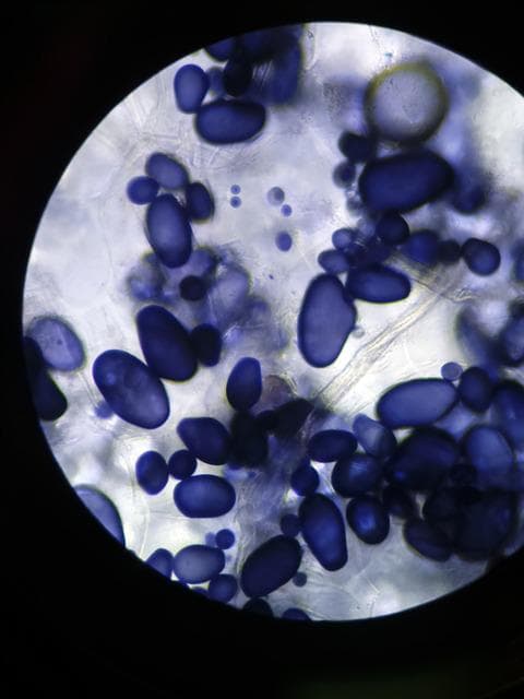 백혈구 수치 낮으면 9