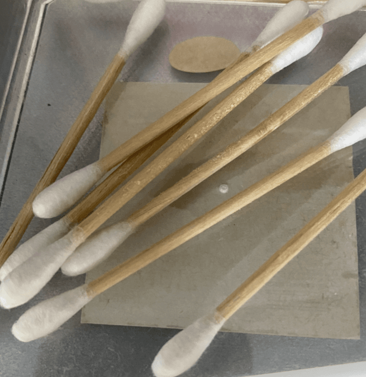 편도결석 빼는 법 4